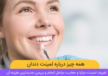 عکس لمینت دندان