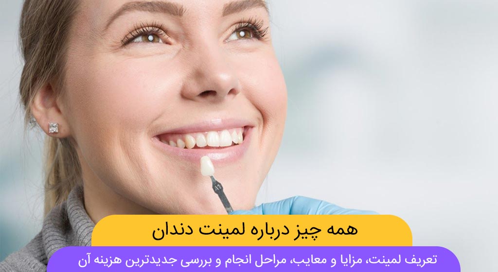 عکس لمینت دندان