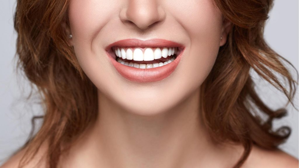 ونیر کامپوزیت چیست؟