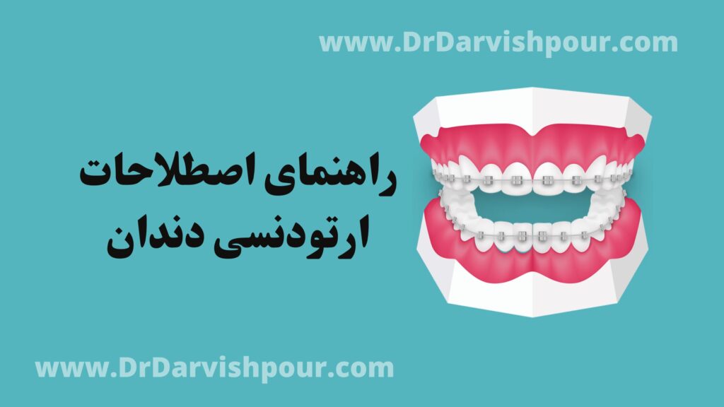 اصطلاحات ارتودنسی دندان