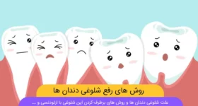 برطرف کردن شلوغی دندان ها شاخص