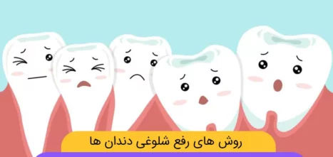برطرف کردن شلوغی دندان ها شاخص