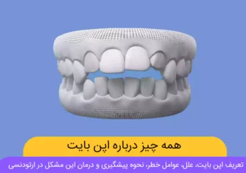 عکس اپن بایت