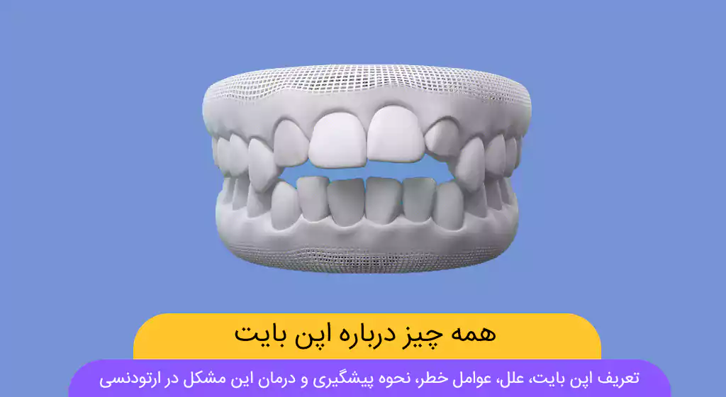 عکس اپن بایت