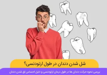 لق شدن دندان ها در ارتودنسی