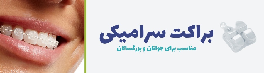 تصویر براکت سرامیکی مناسب برای بزرگسالان و جوانان