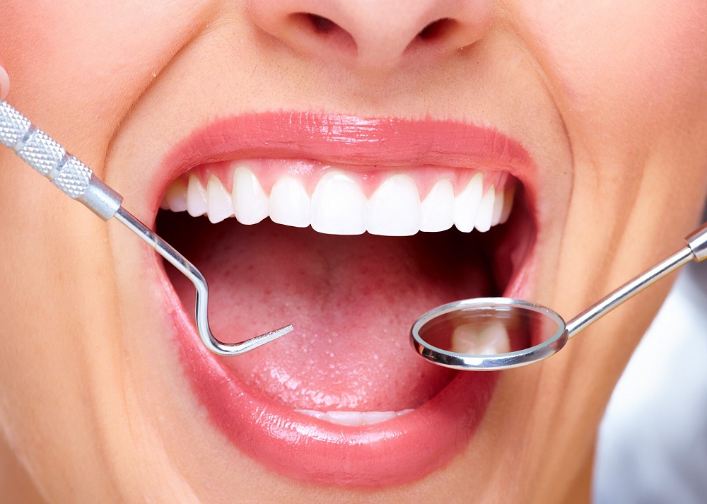 تخصص های دندانپرشکی - متخصص ترمیم و زیبایی دندان- لمینت دندان