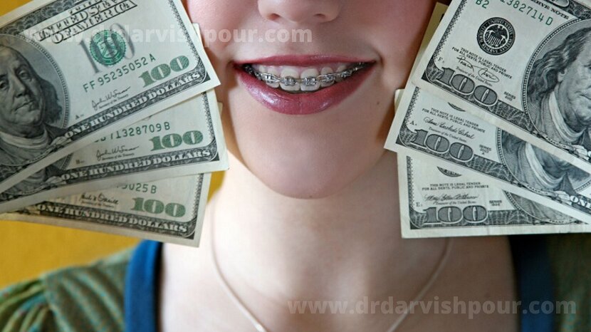 هزینه ارتودنسی دندان، تصویری دختری که ارتودنسی لینگوال دارد و دلار در دستش است