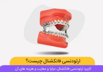 عکس ارتودنسی فانکشنال