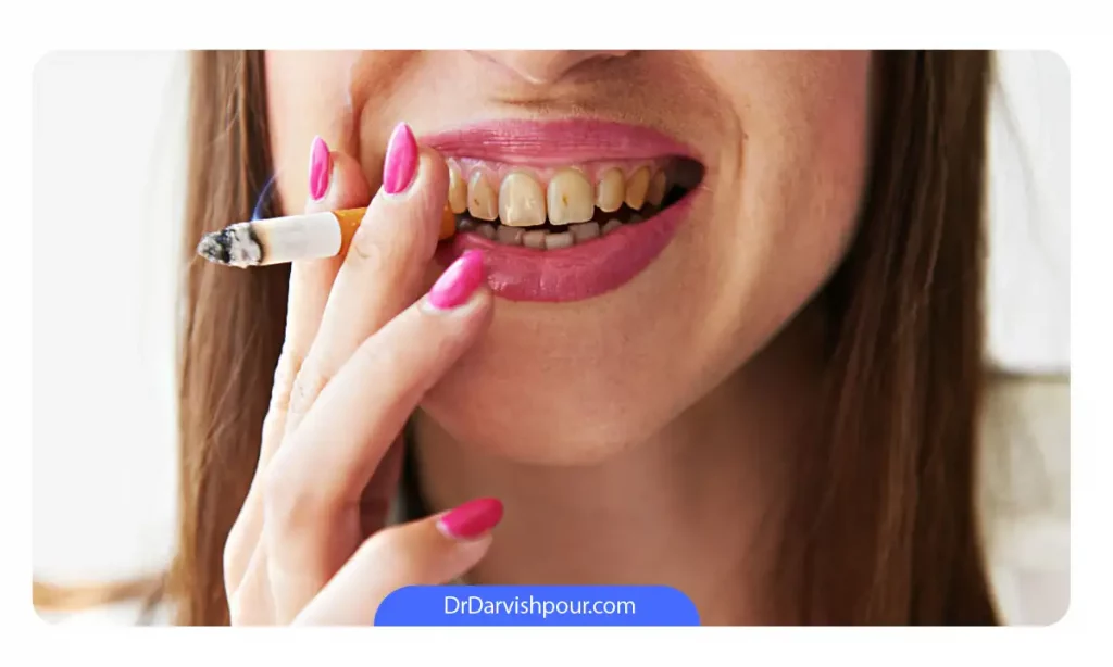 عکس خانمی که سیگار می کشد و دندان هایش زرد است