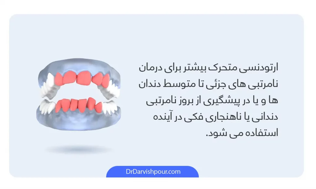 اینفوگرافی ارتودنسی متحرک (تعریف این روش ارتودنسی)