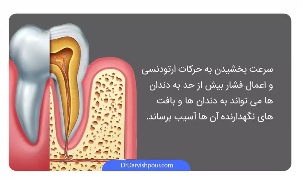 اینفوگرافی عوارض ارتودنسی سریع