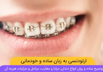 عکس شاخص ارتودنسی دندان