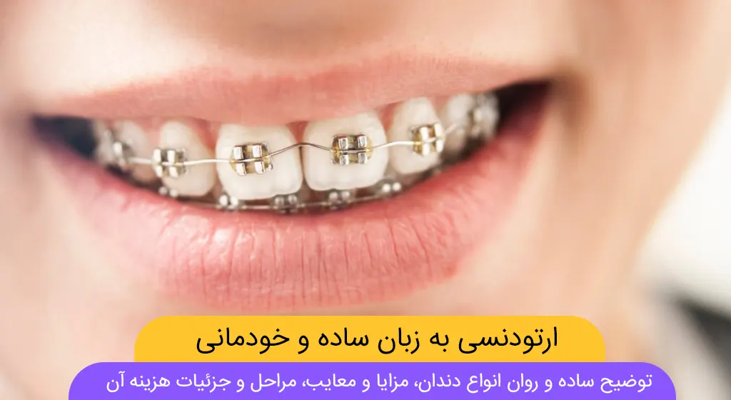 عکس شاخص ارتودنسی دندان