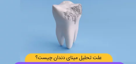 شاخص تحلیل و فرسایش دندان
