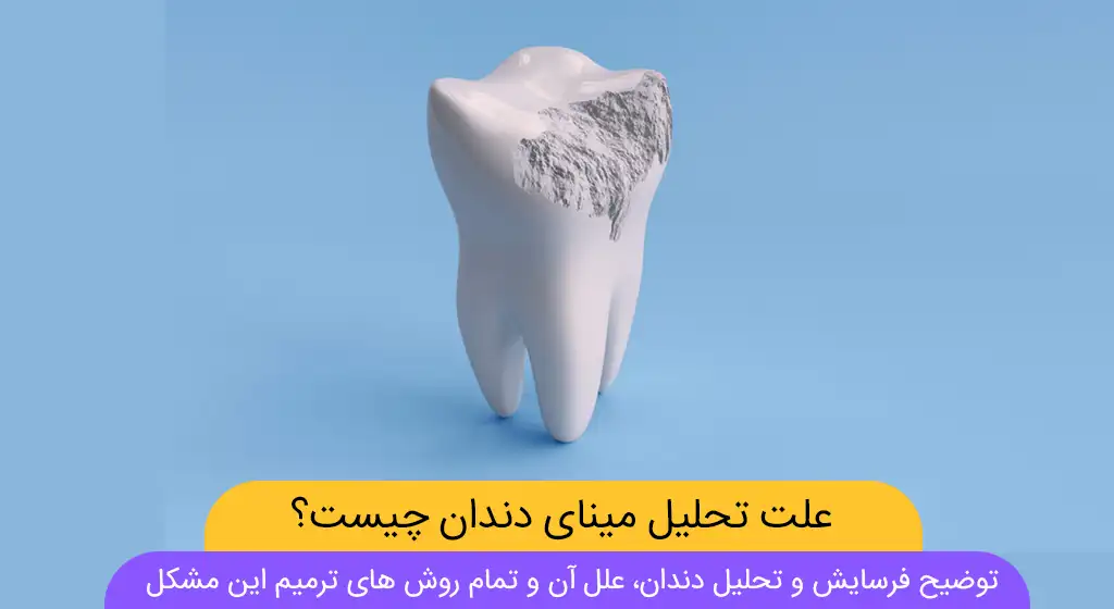 شاخص تحلیل و فرسایش دندان