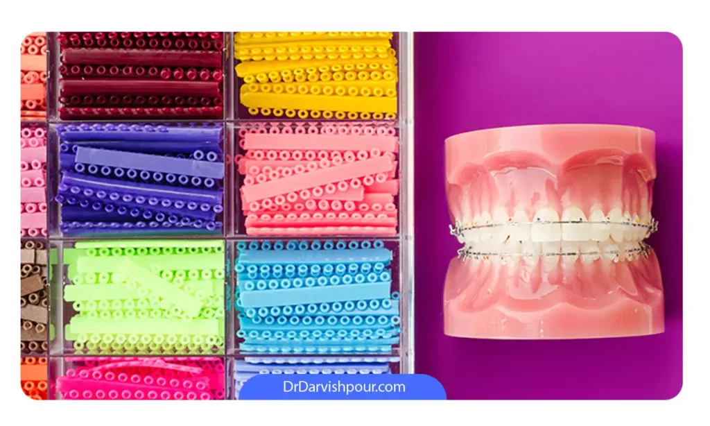 انواع کش های رنگی