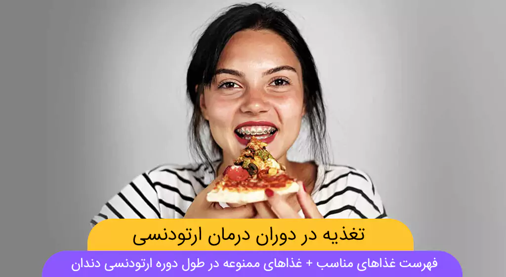 تغذیه در دوران ارتودنسی شاخص