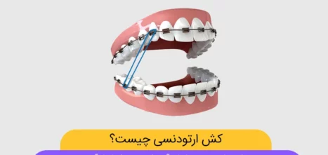 عکس کش ارتودنسی
