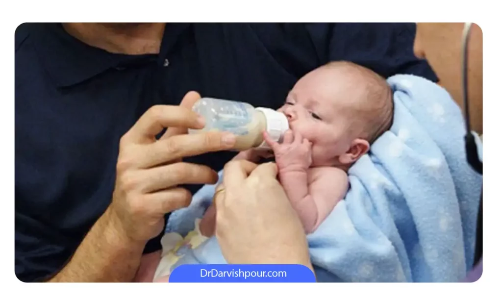 نوزادی که شکاف لب دارد و در حال تغذیه با شیرخشک است