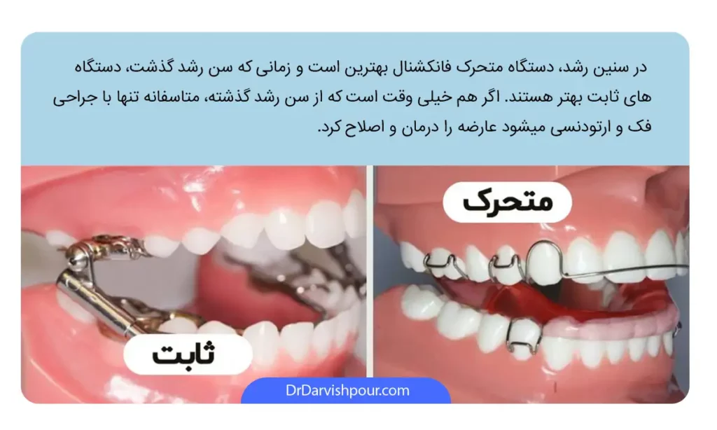 اینفوگرافی ارتودنسی فانکشنال ثابت و متحرک