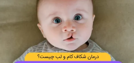 عکس شکاف لب و کام