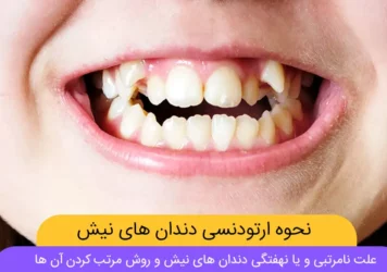 عکس ارتودنسی دندان نیش