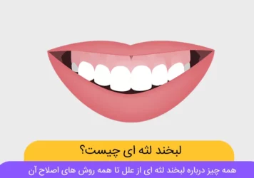 عکس لبخند لثه ای