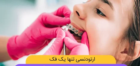 امکان انجام ارتودنسی برای یک فک (فقط بالا یا پایین) عکس