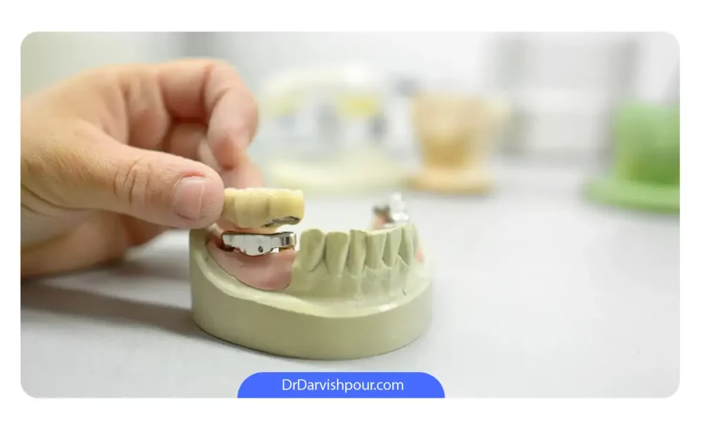 دندان مصنوعی آماده شده