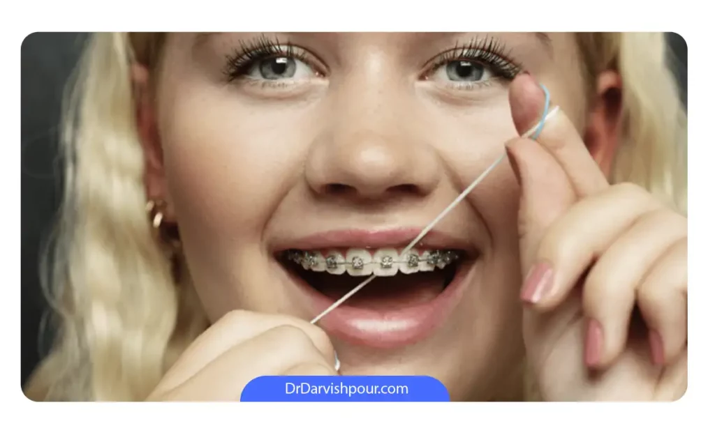 دختری که در حال استفاده از نخ دندان برای تمیز کردن فضای بین دندان ها و وسایل ارتودنسی است