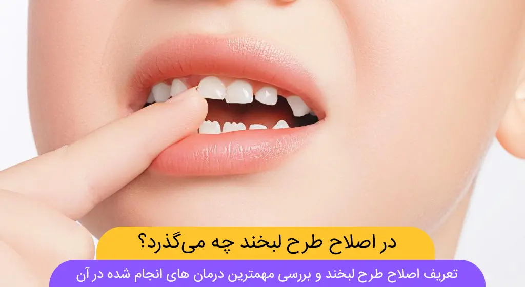 علت کج شدن دندان کودکان عکس