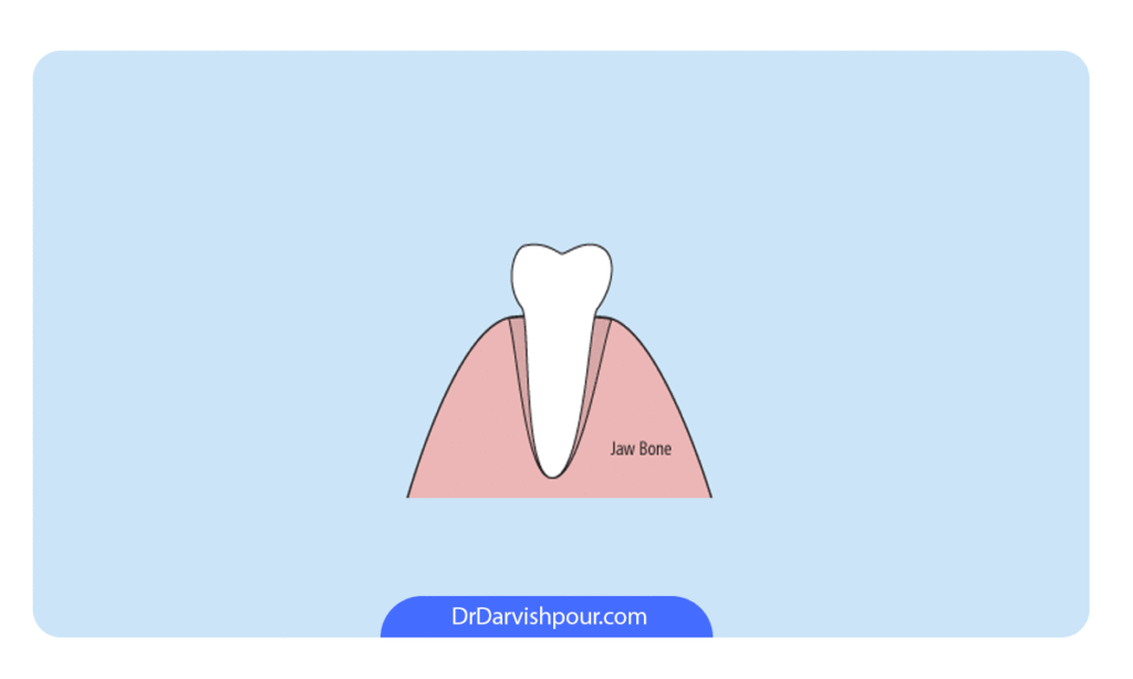 تصویر شماتیک حرکت دندان به چپ و راست