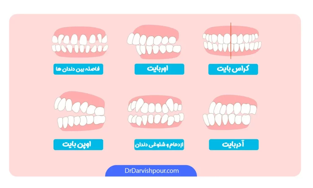 انواع مشکلات دندانی
