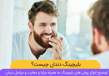 عکس بلیچینگ دندان (نتایج)