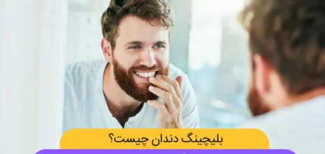 عکس بلیچینگ دندان (نتایج)