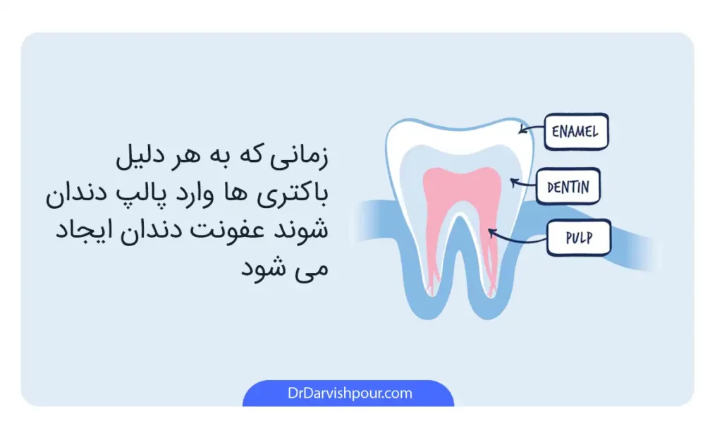 اینفوگرافی عفونت دندان