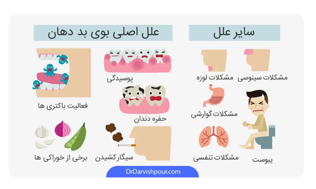 اینفوگرافی علت بوی بد دهان