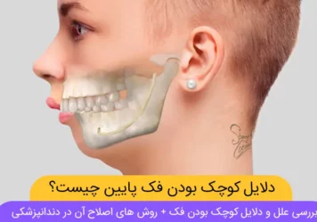 عکس شاخص کوچک بودن فک پایین