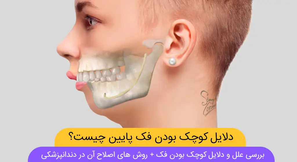 عکس شاخص کوچک بودن فک پایین