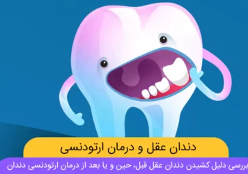 کشیدن دندان عقل برای ارتودنسی