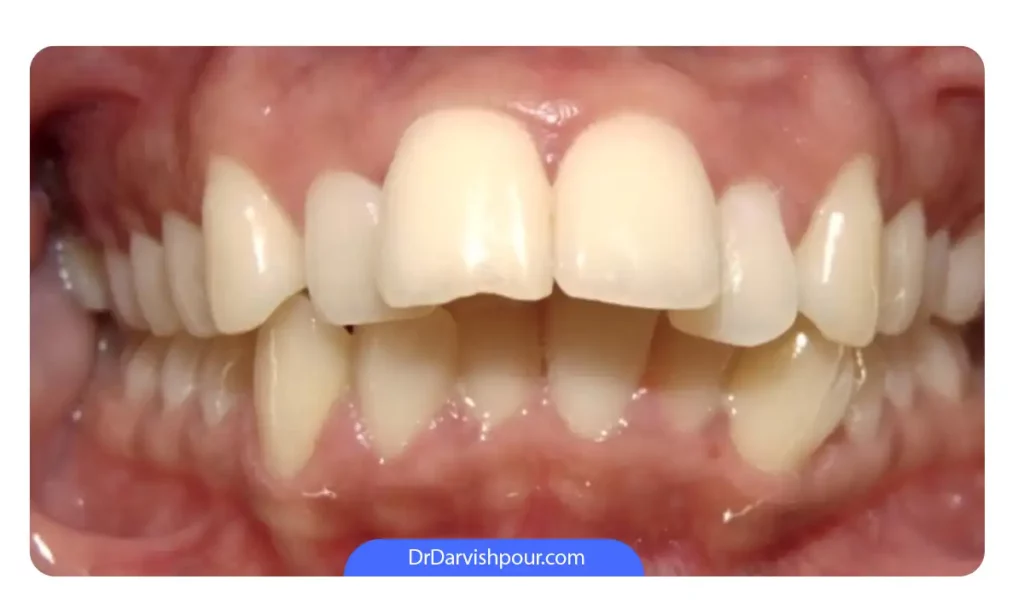 عکس اوربایت