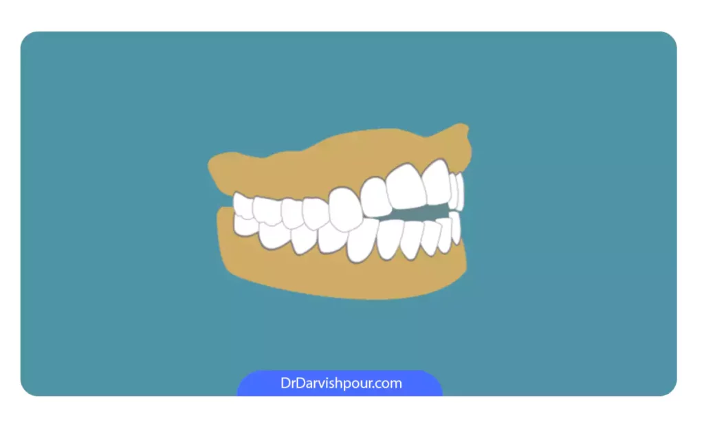 عکس شماتیک اپن بایت
