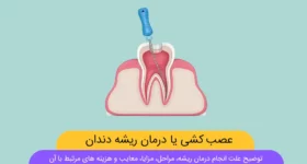 عصب کشی دندان عکس