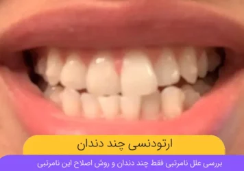 ارتودنسی چند دندان