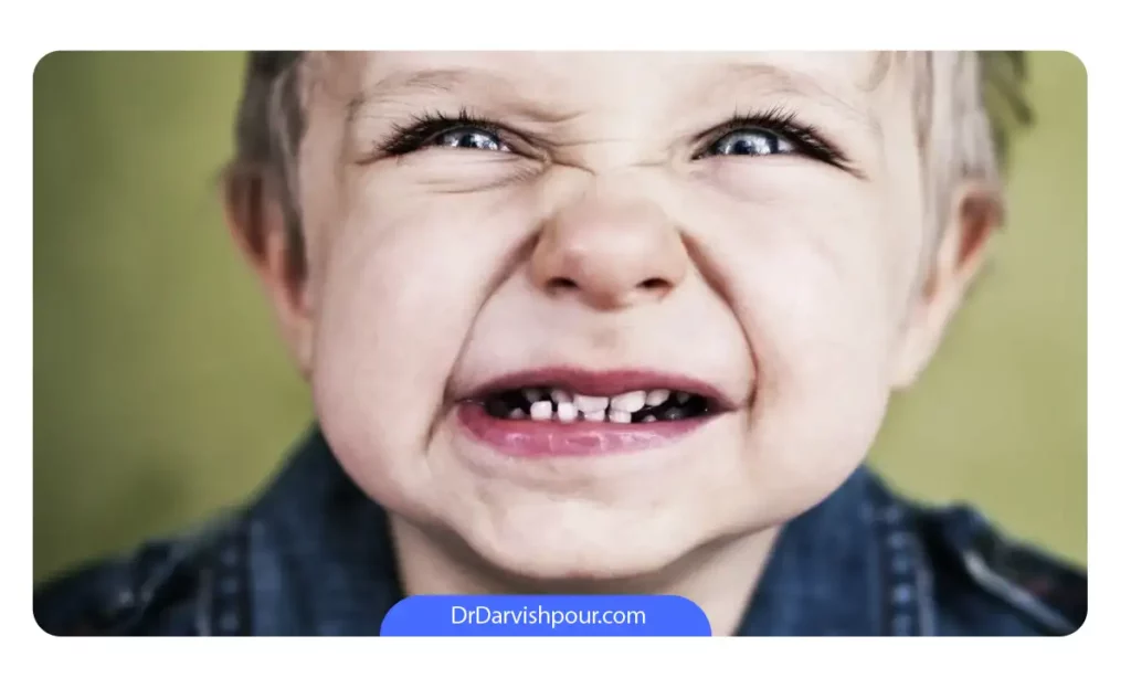 پسربچه ای که در حال انجام دندان قروچه است