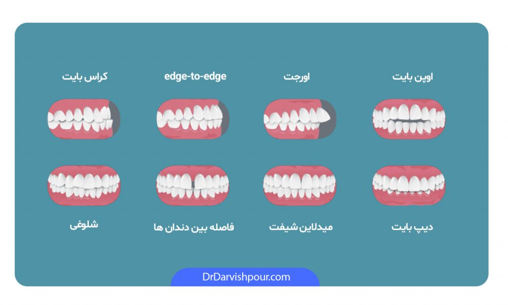 اینفوگرافی انواع ناهنجاری های دندانی و فکی