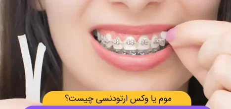 عکس موم ارتودنسی