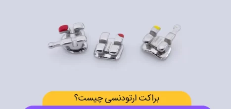 انواع ارتودنسی دندان