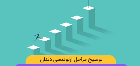 توضیح مراحل ارتودنسی دندان با فیلم و عکس